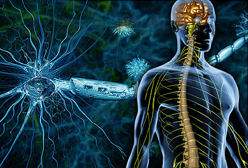 A Naturopathic Approach to Multiple Sclerosis