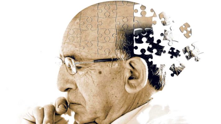 Alzheimer’s Disease and Dementia